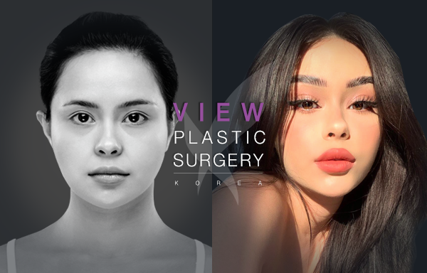 plastic surgery in korea